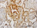 IL15 Antibody in Immunohistochemistry (Paraffin) (IHC (P))