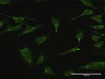 IMPA1 Antibody in Immunocytochemistry (ICC/IF)