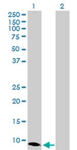 CXCL10 Antibody in Western Blot (WB)