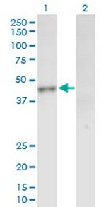 INPP1 Antibody in Western Blot (WB)