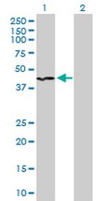 INPP1 Antibody in Western Blot (WB)