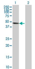 INPP5A Antibody in Western Blot (WB)