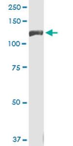 INSRR Antibody in Western Blot (WB)