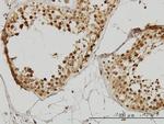 IRAK1 Antibody in Immunohistochemistry (Paraffin) (IHC (P))