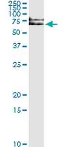 IRAK1 Antibody in Immunoprecipitation (IP)