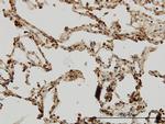 IRAK1 Antibody in Immunohistochemistry (Paraffin) (IHC (P))