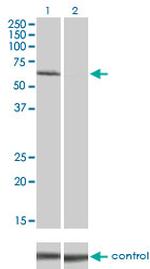 IRAK1 Antibody in Western Blot (WB)