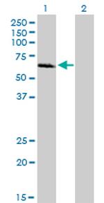 IRAK1 Antibody in Western Blot (WB)