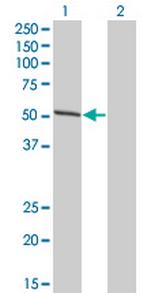 IRF4 Antibody in Western Blot (WB)