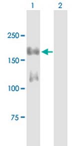 IRS1 Antibody in Western Blot (WB)