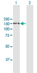 ITGA4 Antibody in Western Blot (WB)