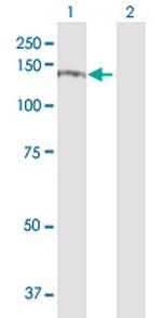 ITGA4 Antibody in Western Blot (WB)