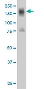 ITGA4 Antibody in Western Blot (WB)