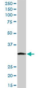 ITPK1 Antibody in Western Blot (WB)