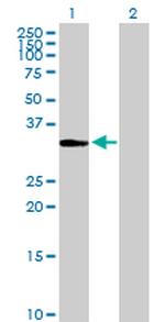 ITPK1 Antibody in Western Blot (WB)