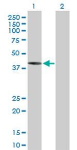 IVD Antibody in Western Blot (WB)