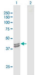 IVD Antibody in Western Blot (WB)