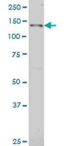 JAG2 Antibody in Western Blot (WB)