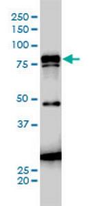 JUP Antibody in Western Blot (WB)