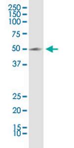 KCNN4 Antibody in Western Blot (WB)