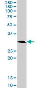 KHK Antibody in Western Blot (WB)