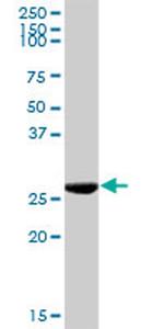 KHK Antibody in Western Blot (WB)