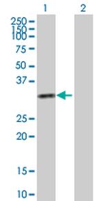 KHK Antibody in Western Blot (WB)