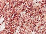 KHK Antibody in Immunohistochemistry (Paraffin) (IHC (P))