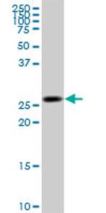 KHK Antibody in Western Blot (WB)