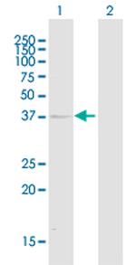 KIR2DL1 Antibody in Western Blot (WB)