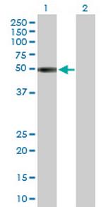 KIR2DL1 Antibody in Western Blot (WB)