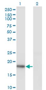 KISS1 Antibody in Western Blot (WB)