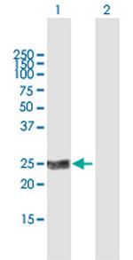 KLK2 Antibody in Western Blot (WB)