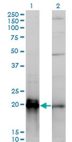 KRAS Antibody in Western Blot (WB)