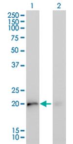 KRAS Antibody in Western Blot (WB)