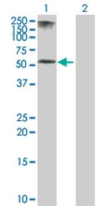 KRT5 Antibody in Western Blot (WB)