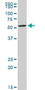 KRT5 Antibody in Western Blot (WB)