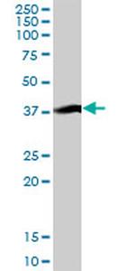 KRT17 Antibody in Western Blot (WB)