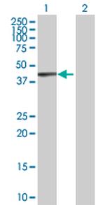 KRT17 Antibody in Western Blot (WB)