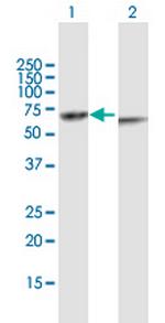 KRT82 Antibody in Western Blot (WB)