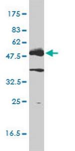 LCK Antibody in Western Blot (WB)