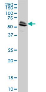 LCK Antibody in Western Blot (WB)