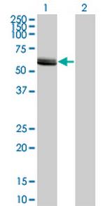 LCK Antibody in Western Blot (WB)