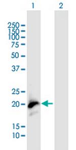 LCN2 Antibody in Western Blot (WB)