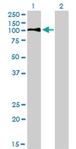 LDLR Antibody in Western Blot (WB)