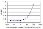 LEPR Antibody in ELISA (ELISA)