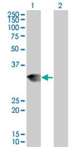 LFNG Antibody in Western Blot (WB)