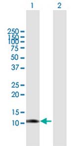 LGALS1 Antibody in Western Blot (WB)