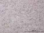 LHX1 Antibody in Immunohistochemistry (Paraffin) (IHC (P))