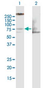 LIMK1 Antibody in Western Blot (WB)